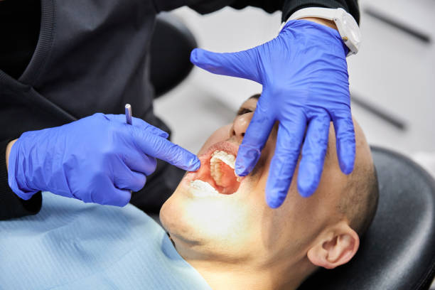 Best Knocked-Out Tooth Emergency  in Renville, MN